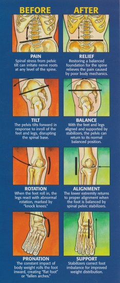 Before and After Misalignment - Dr Sarah Deam Presentation