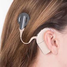 Cochlear implant