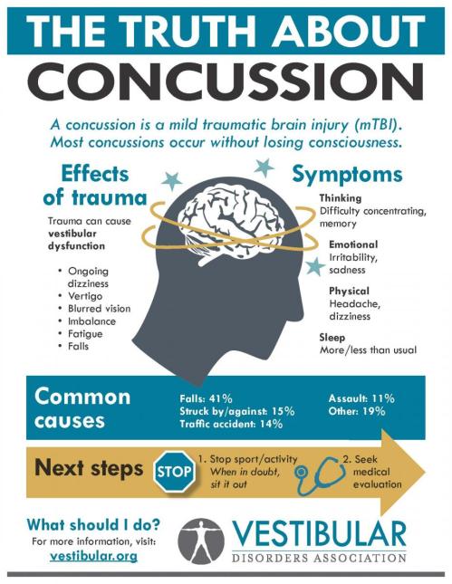 Concussion VEDA infographic